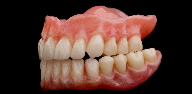Upper Dentures Springfield OH 45501